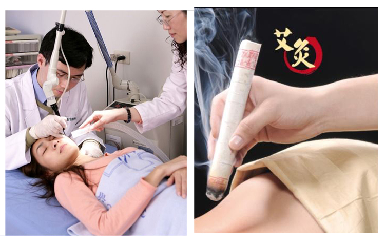 艾灸91视频成人免费
